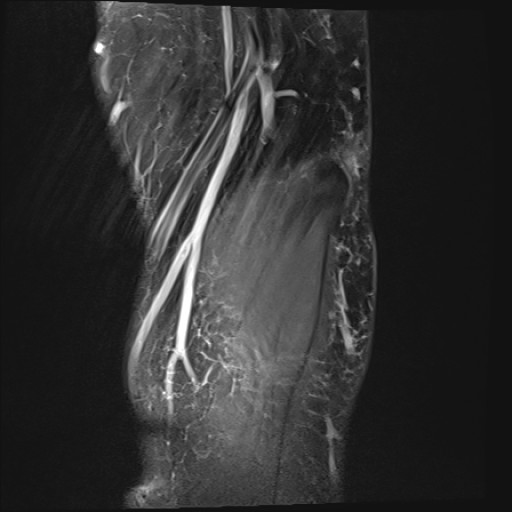 Click on the Serie image to view the images of Wieszt, Gnter